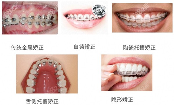 苏州湖东美奥口腔哪个医生好