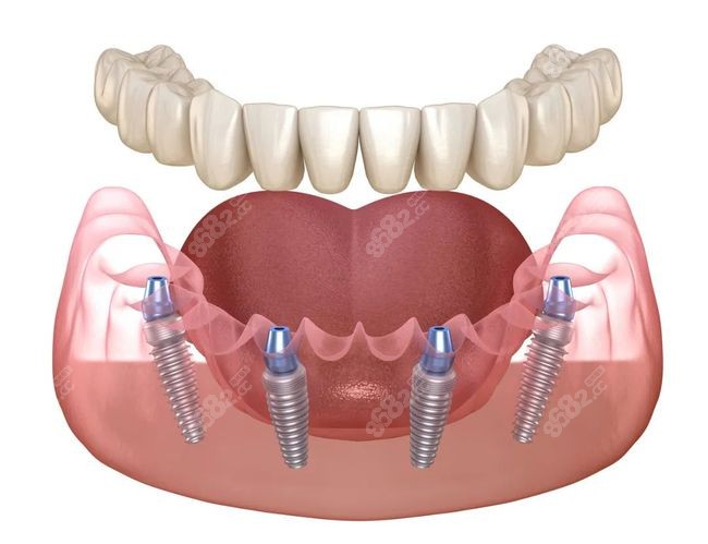 苏州姑苏区美奥齿科比较好的医生简介