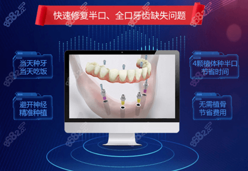 湛江致美口腔醫(yī)院數(shù)字化種植牙技術(shù)