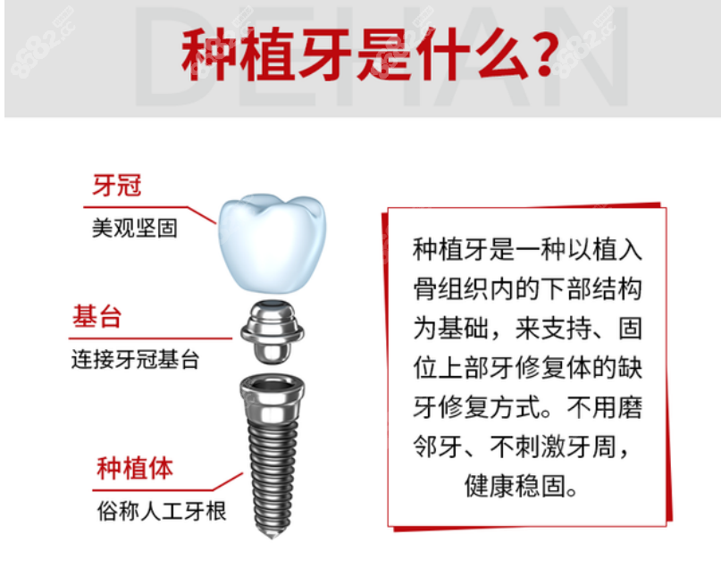 德韩口腔医院种植牙8682.cc