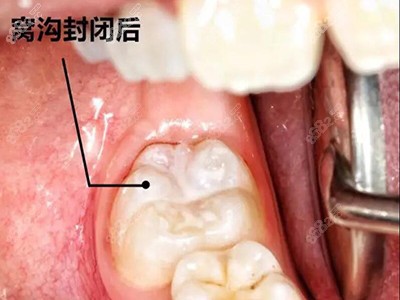 厦门登特口腔