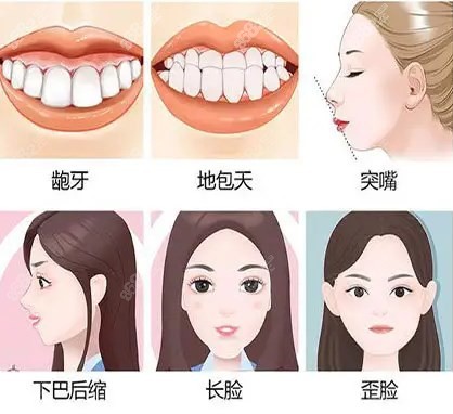 广大正颌手术解决的颌面问题