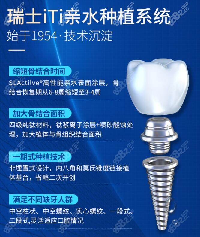 种植体瑞士iti品牌介绍,解说瑞士iti三种档次价格及型号区别