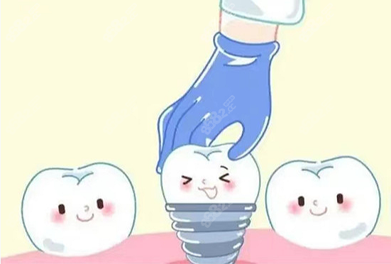 南京單顆種植牙2022價格表
