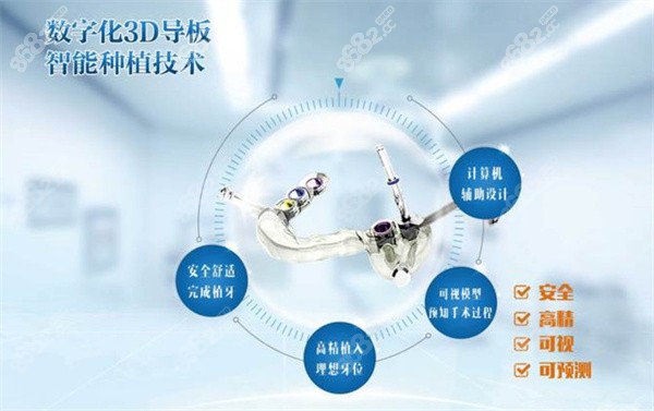 杭州美奥口腔数字化3D导板种植技术优点