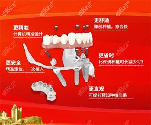 蓝天口腔医院种植牙优势 蓝天口腔医院种植牙优势