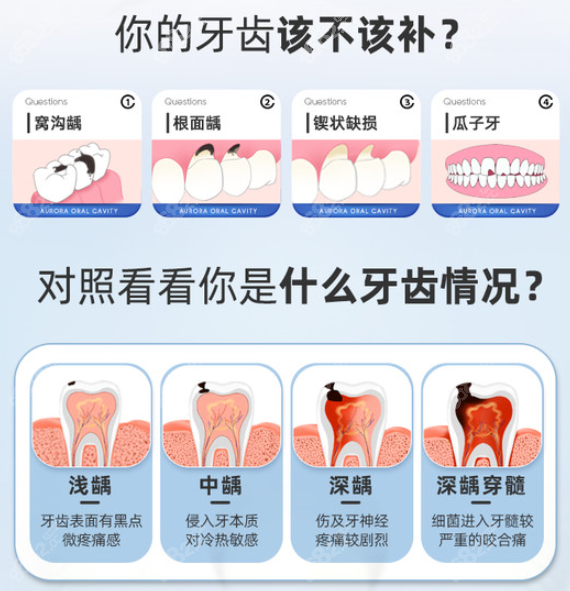 <!--<i data=20240705-sp></i>-->口腔常做的补牙类型图