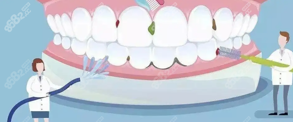 洗牙