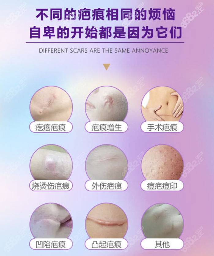 大连京城皮肤病医院可以治疗哪些疤痕