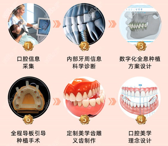 杭州薇琳口腔种植牙流程