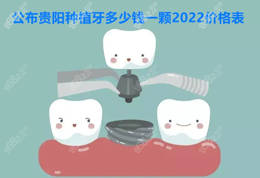 全新贵阳种植牙多少钱一颗 全新贵阳种植牙多少钱一颗