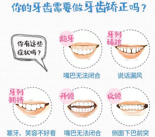深圳矫正牙齿大概要花费多少钱