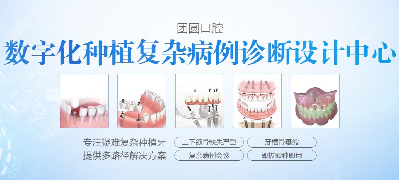 团圆昌岗口腔的数字化种植科室