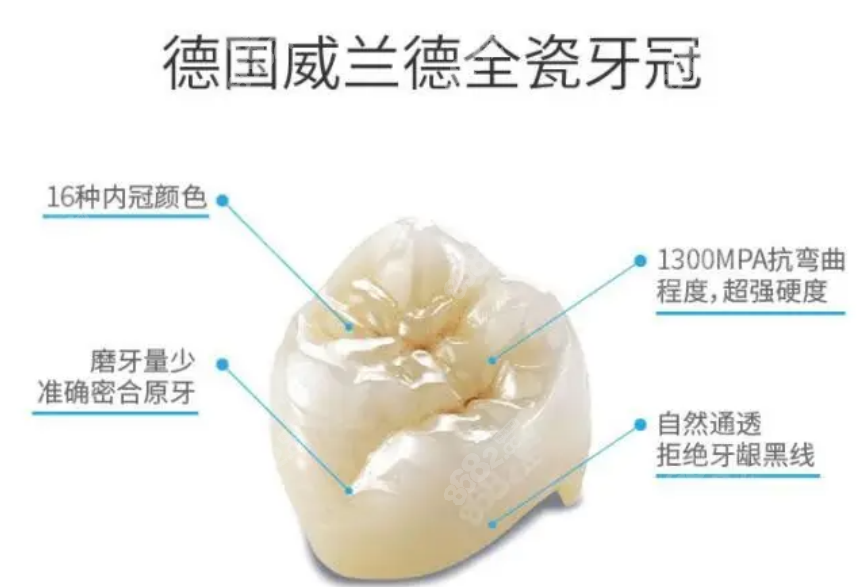 烤瓷牙