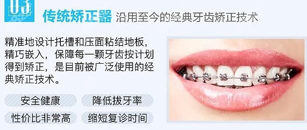 2022深圳成人牙齿矫正价格表