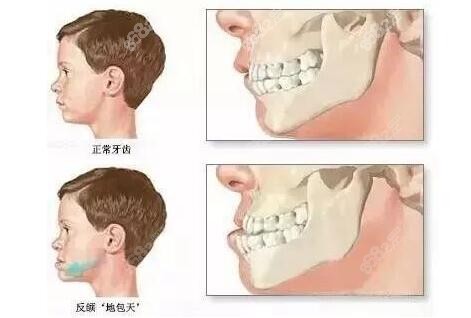 长沙牙齿矫正医院排名榜是牙大夫/好牙依/美奥口腔好价格合理