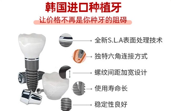 韩国登腾二代种植体的优势点