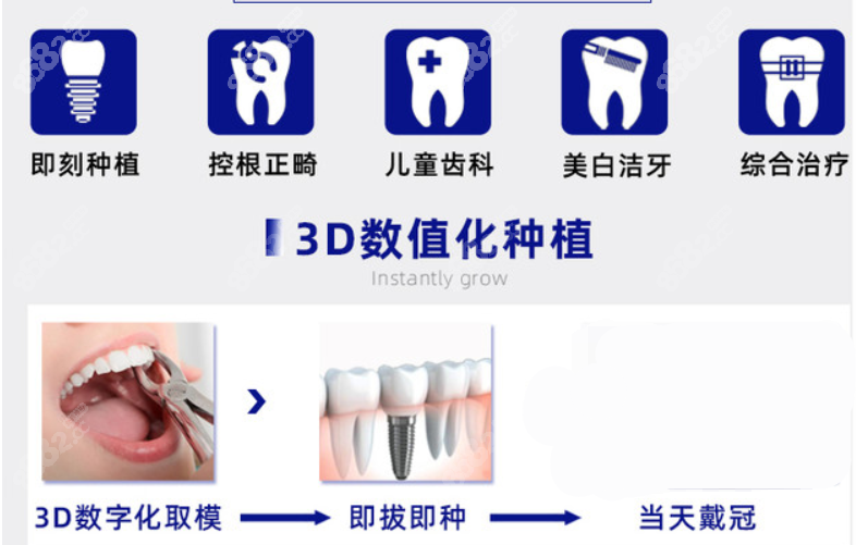 东莞固德口腔3d数字化种植牙
