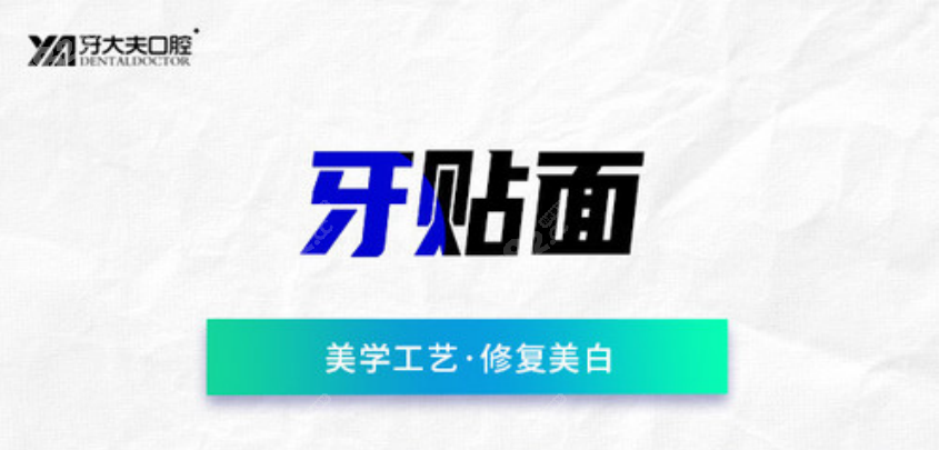 牙贴面