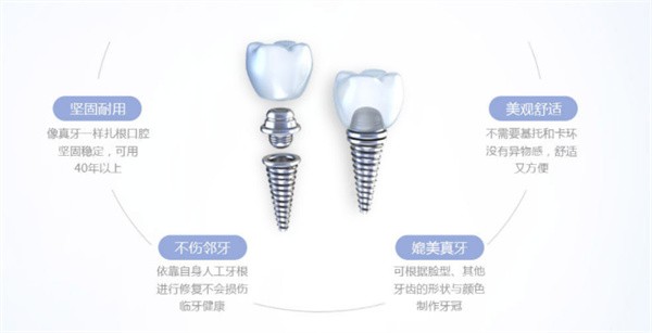 种植牙的优势