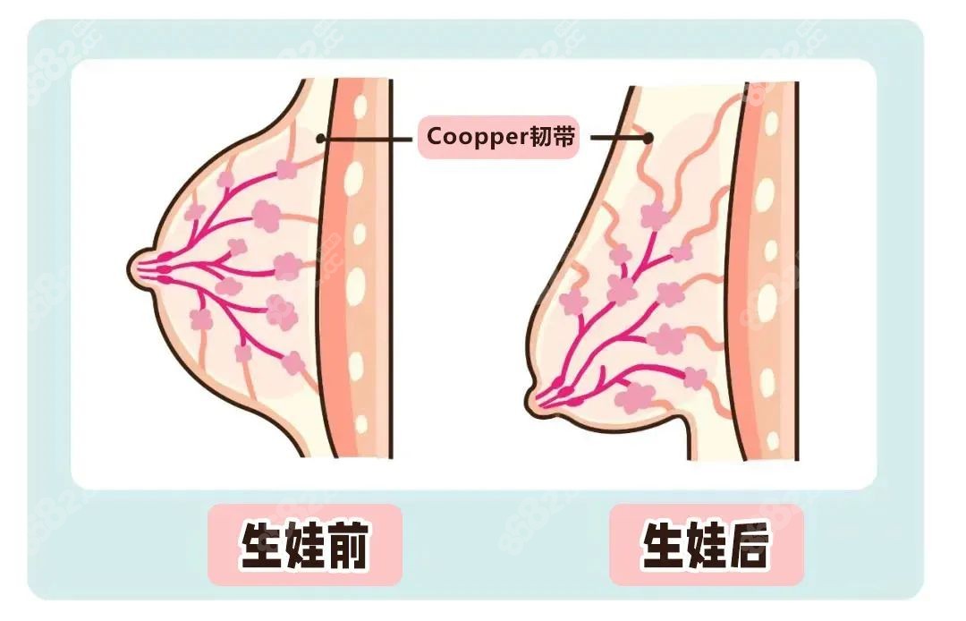 重庆华美张梅丰胸技术好，擅长哺乳后下垂的胸做大做挺