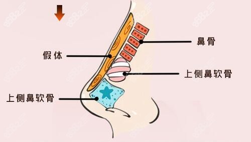 金柱翰做鼻子技术