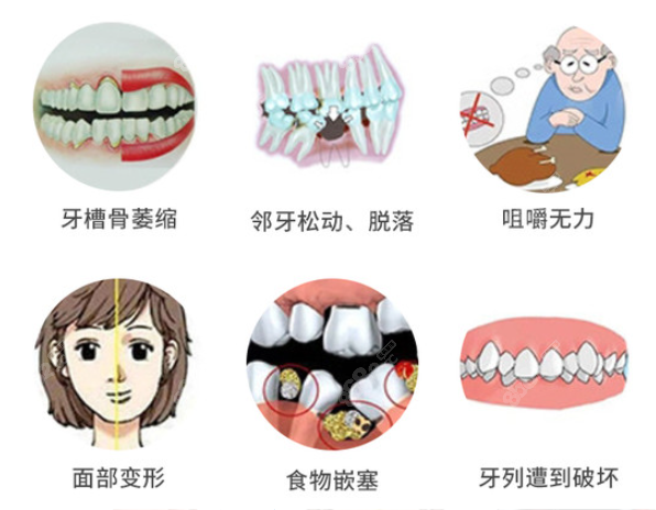 济宁美雅口腔种植牙满足情况