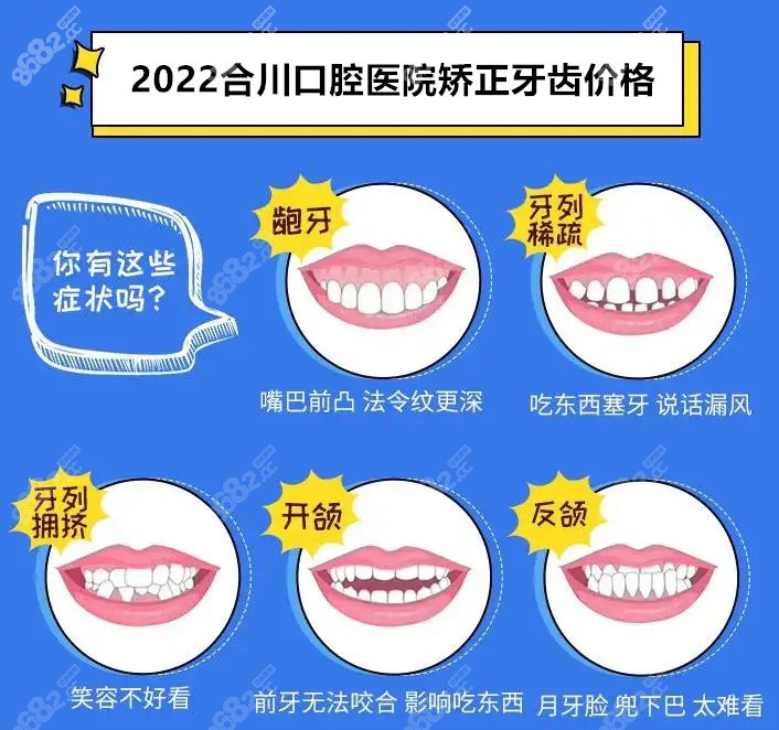 2022合川口腔医院矫正牙齿价格
