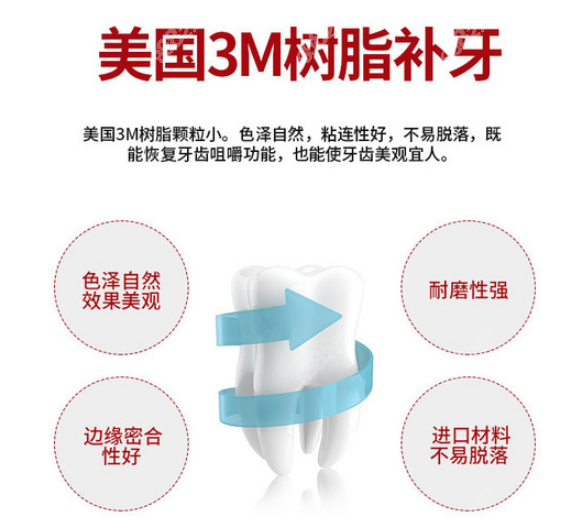 银川做美国3m纳米树脂补牙优势