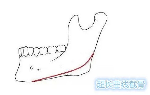 罗延平坐诊广州广大整形医院