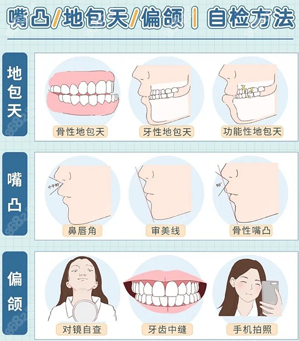 长沙正颌手术费用