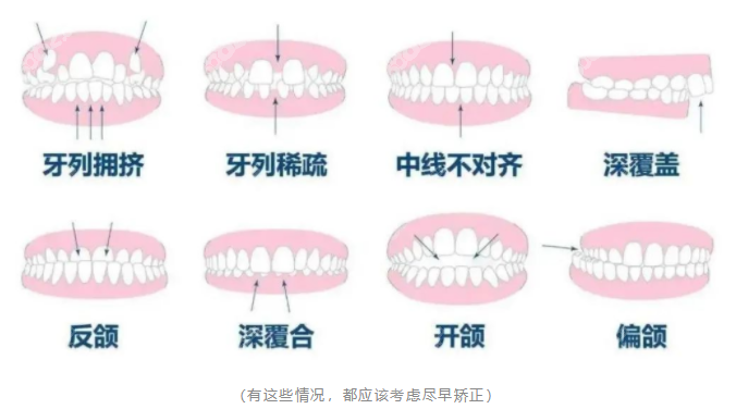 上海松丰口腔医院牙齿矫正适应症状