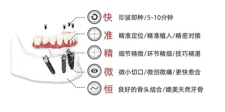 泉州丰泽柏德口腔种植技术