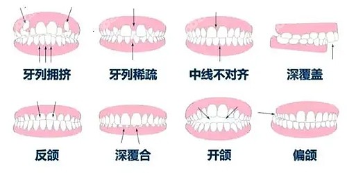 www.8682.cc南昌口腔医院牙齿矫正价格表