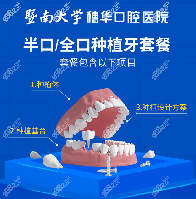 穗华口腔种植牙多少钱一颗