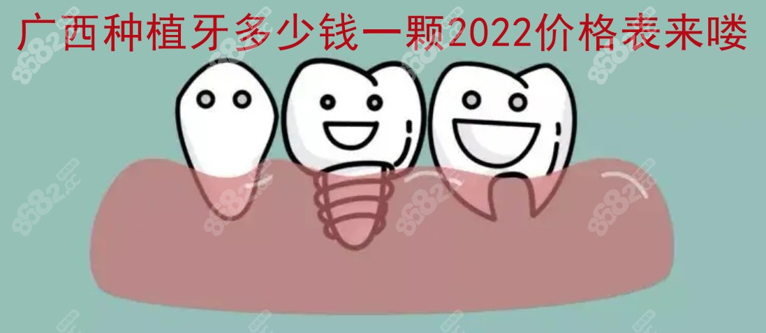 广西种植牙多少钱一颗2022