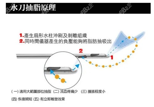 成都正规医院吸脂收费价格表