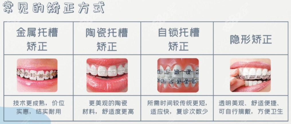 常见的牙齿矫正方式有哪些