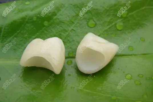 贝臣口腔牙冠类型、品牌及价格