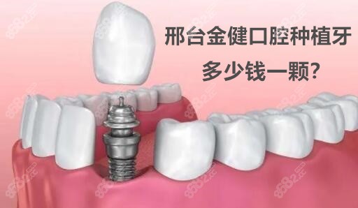 邢台金健口腔种植牙多钱一颗