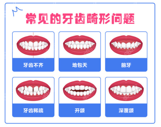 兰州皓亚口腔做牙齿矫正的类型图