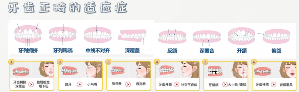 什么样的牙齿需要做牙齿矫正www.8682.cc