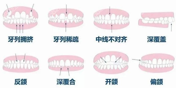 出现这些问题都可以做矫正