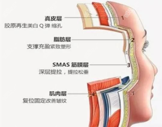 上海美莱做微拉美面部提升示意图