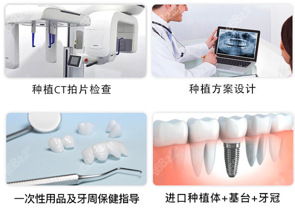 <!--<i data=20240705-sp></i>-->口腔种植牙步骤示意图