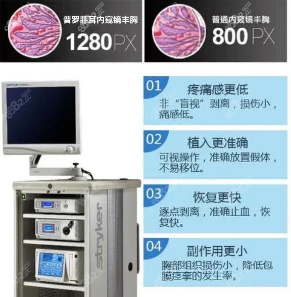 韩国Profile内窥镜设备