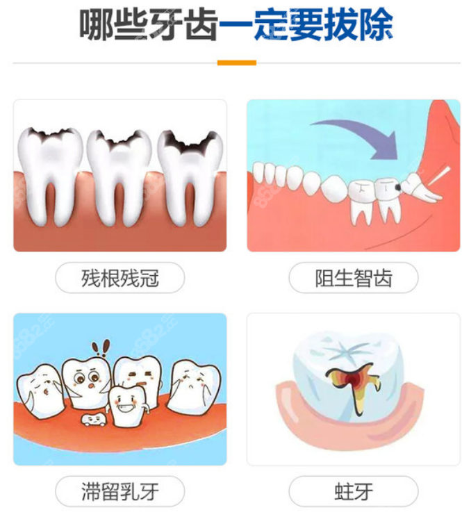 纽大口腔医院拔牙