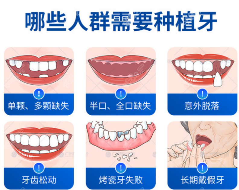 曙光口腔种牙