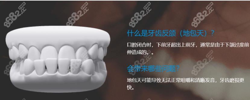 美立刻隐形矫正