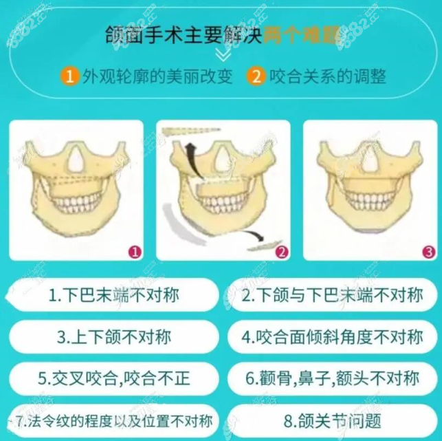 广州广大颌面矫正歪嘴优势
